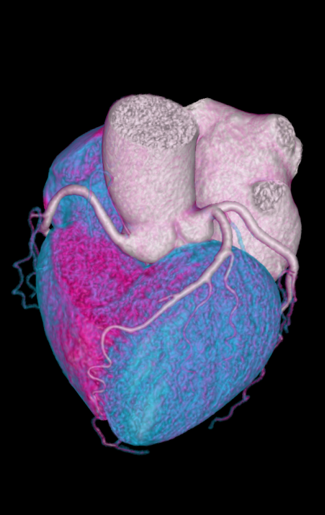 联影ct怎么样科技助力健康丨“全球顶尖超高端”联影天河640层CT启用“满百天”_https://www.jmylbn.com_新闻资讯_第8张
