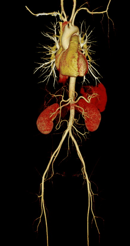 联影ct怎么样科技助力健康丨“全球顶尖超高端”联影天河640层CT启用“满百天”_https://www.jmylbn.com_新闻资讯_第13张