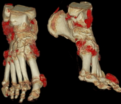 联影ct怎么样科技助力健康丨“全球顶尖超高端”联影天河640层CT启用“满百天”_https://www.jmylbn.com_新闻资讯_第18张