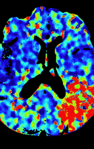 联影ct怎么样科技助力健康丨“全球顶尖超高端”联影天河640层CT启用“满百天”_https://www.jmylbn.com_新闻资讯_第12张