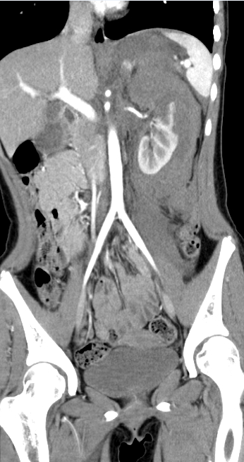 联影ct怎么样科技助力健康丨“全球顶尖超高端”联影天河640层CT启用“满百天”_https://www.jmylbn.com_新闻资讯_第16张