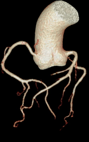 联影ct怎么样科技助力健康丨“全球顶尖超高端”联影天河640层CT启用“满百天”_https://www.jmylbn.com_新闻资讯_第7张