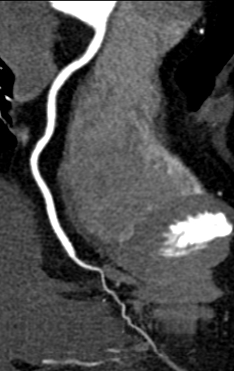 联影ct怎么样科技助力健康丨“全球顶尖超高端”联影天河640层CT启用“满百天”_https://www.jmylbn.com_新闻资讯_第9张