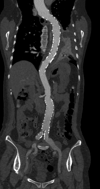联影ct怎么样科技助力健康丨“全球顶尖超高端”联影天河640层CT启用“满百天”_https://www.jmylbn.com_新闻资讯_第14张