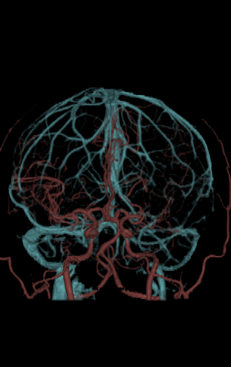 联影ct怎么样科技助力健康丨“全球顶尖超高端”联影天河640层CT启用“满百天”_https://www.jmylbn.com_新闻资讯_第11张