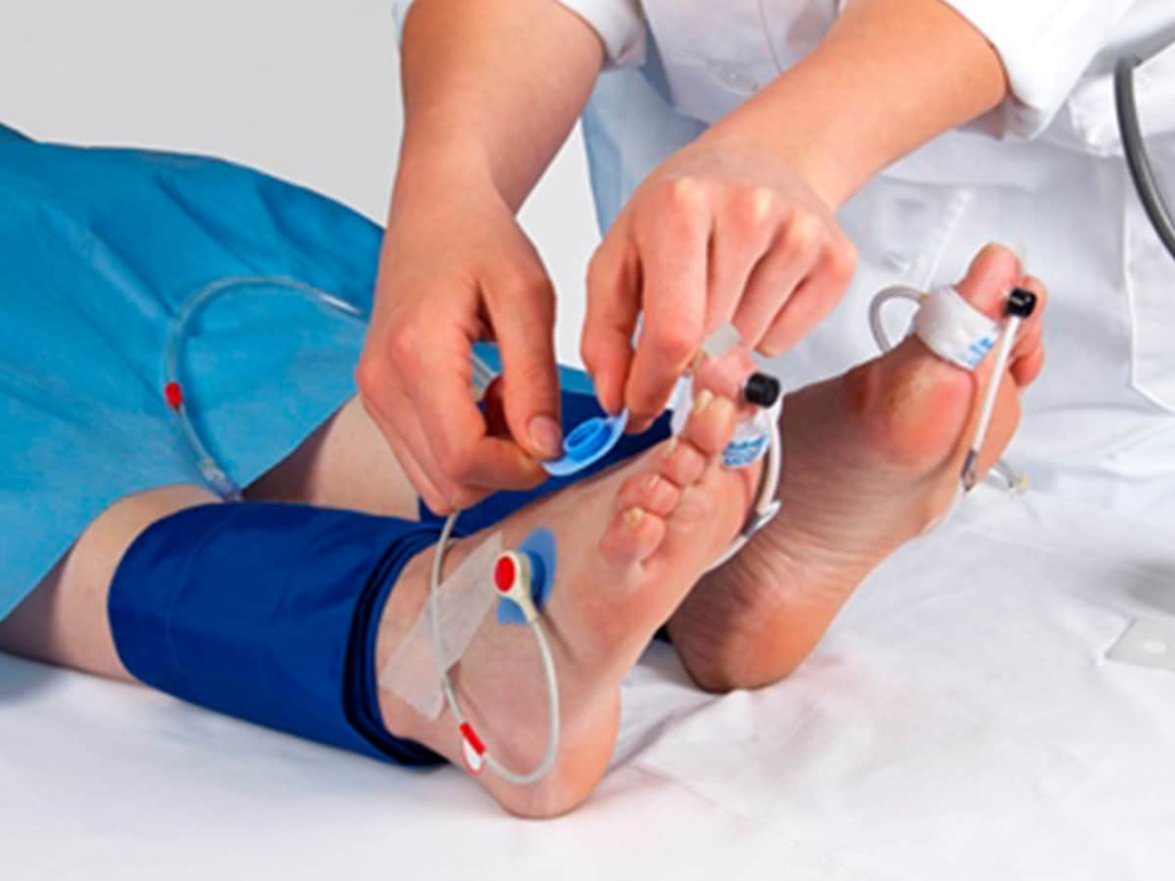 什么是经皮氧分压【医讲堂】糖尿病足防治利器——经皮氧分压检测_https://www.jmylbn.com_新闻资讯_第7张