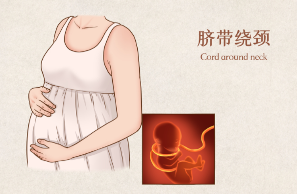 为什么剪脐带要先夹住“咔嚓”一刀剪掉脐带，宝宝会疼吗？_https://www.jmylbn.com_新闻资讯_第6张