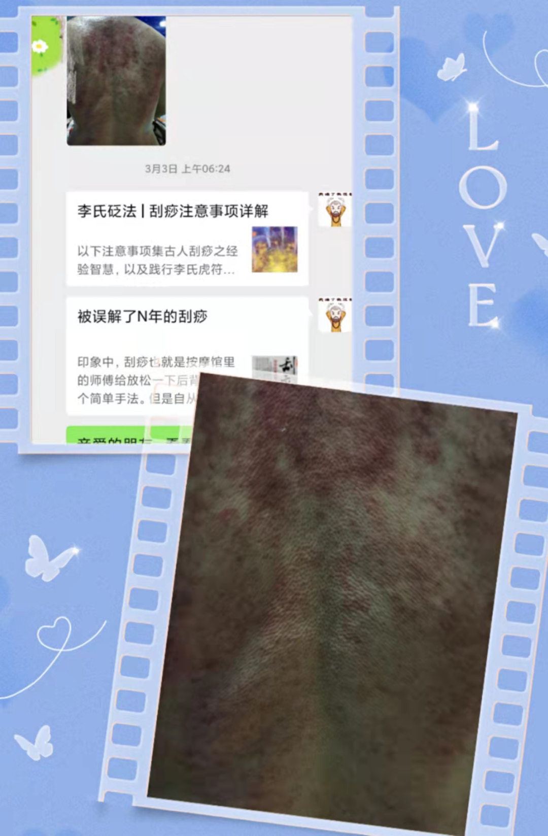 怎么诊断肝胆亚健康李氏砭法丨008调理亚健康状态，砭法过后感觉无比轻松_https://www.jmylbn.com_新闻资讯_第3张