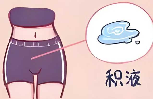 5.png