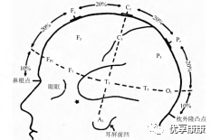 tms什么医疗康复基础 ｜ 重复经颅磁刺激(TMS)治疗专家共识，点击共识！_https://www.jmylbn.com_新闻资讯_第5张