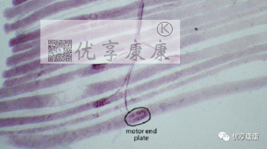 理疗电极贴片怎么用康复治疗师怎样正确使用中频电极片？_https://www.jmylbn.com_新闻资讯_第12张
