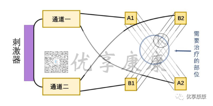 理疗电极贴片怎么用康复治疗师怎样正确使用中频电极片？_https://www.jmylbn.com_新闻资讯_第9张