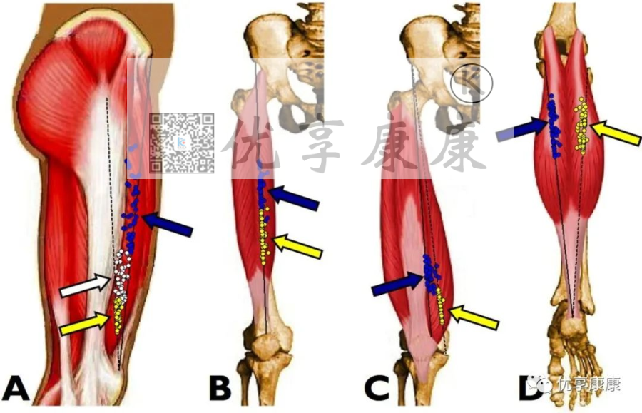 理疗电极贴片怎么用康复治疗师怎样正确使用中频电极片？_https://www.jmylbn.com_新闻资讯_第11张