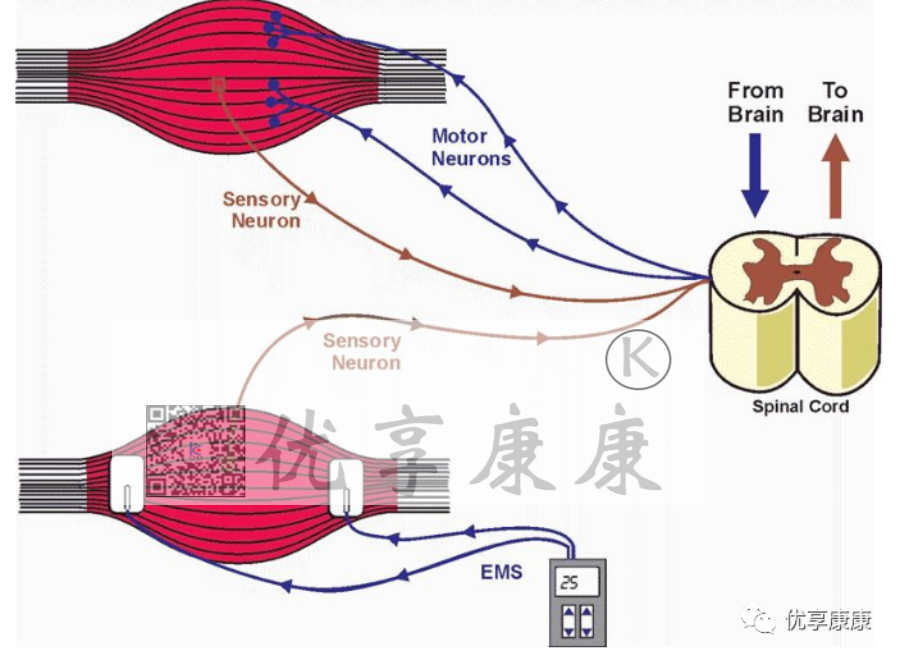 理疗电极贴片怎么用康复治疗师怎样正确使用中频电极片？_https://www.jmylbn.com_新闻资讯_第10张