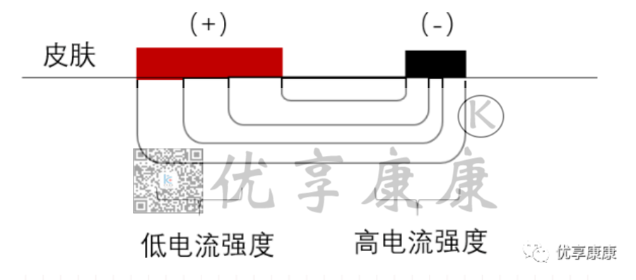 理疗电极贴片怎么用康复治疗师怎样正确使用中频电极片？_https://www.jmylbn.com_新闻资讯_第8张