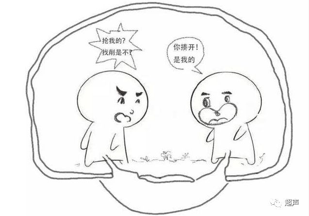 彩超t指什么双胎绒毛膜性的彩超鉴别-上海聚慕医疗器械有限公司