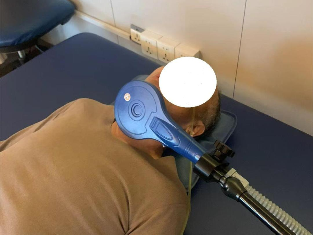 tms什么医疗神经调控——TMS技术，你get到了吗_https://www.jmylbn.com_新闻资讯_第13张