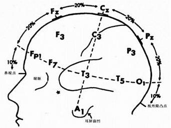 tms什么医疗神经调控——TMS技术，你get到了吗_https://www.jmylbn.com_新闻资讯_第6张