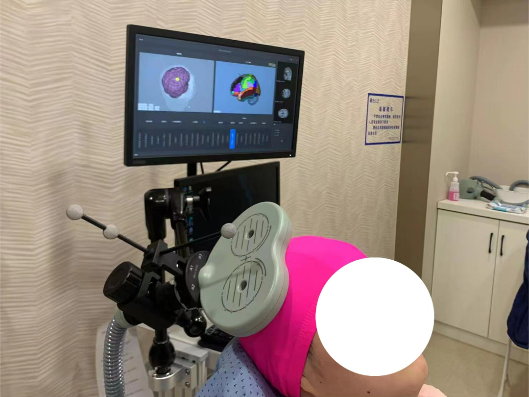 tms什么医疗神经调控——TMS技术，你get到了吗_https://www.jmylbn.com_新闻资讯_第12张