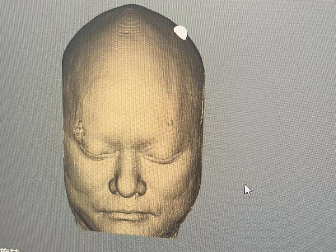 tms什么医疗神经调控——TMS技术，你get到了吗_https://www.jmylbn.com_新闻资讯_第7张