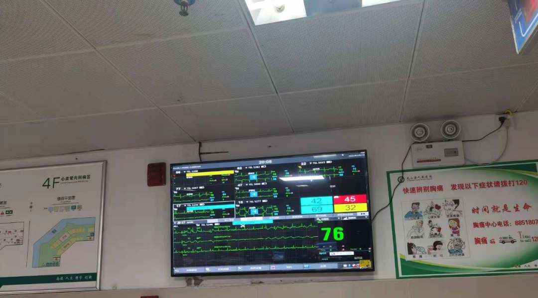 心电遥测怎么戴智能设备︱遥测心电监护仪在临床中的应用_https://www.jmylbn.com_新闻资讯_第3张