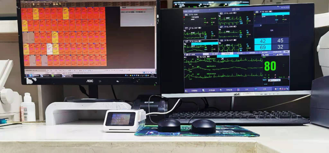 心电遥测怎么戴智能设备︱遥测心电监护仪在临床中的应用_https://www.jmylbn.com_新闻资讯_第4张