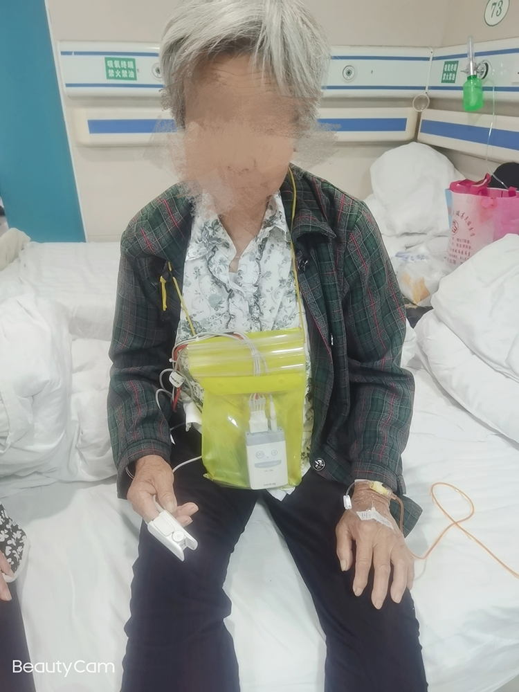 心电遥测怎么戴智能设备︱遥测心电监护仪在临床中的应用_https://www.jmylbn.com_新闻资讯_第5张
