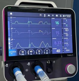 什么是监护仪一起揭秘ICU里的救命神器--监护治疗仪器设备_https://www.jmylbn.com_新闻资讯_第8张