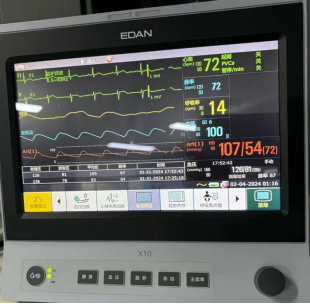 什么是监护仪一起揭秘ICU里的救命神器--监护治疗仪器设备_https://www.jmylbn.com_新闻资讯_第4张