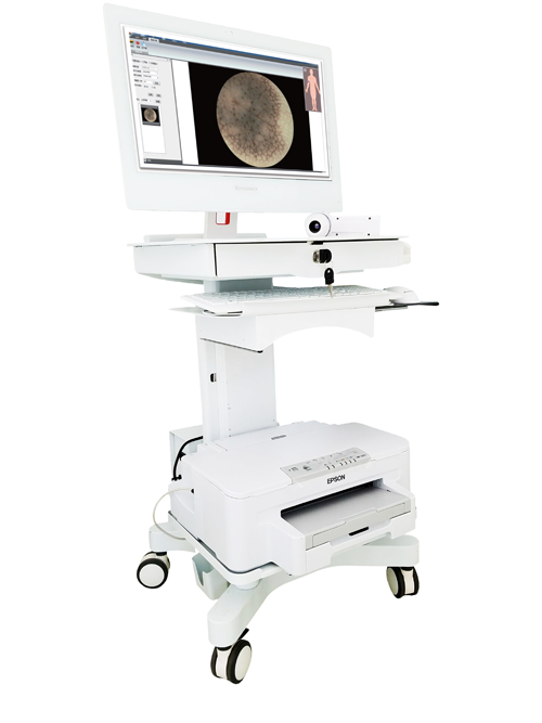 医用皮肤镜什么牌子好长痣、红肿、瘙痒、脱发......感觉自己得了皮肤病？皮肤镜检查为您一探究竟！_https://www.jmylbn.com_新闻资讯_第6张