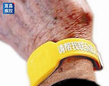 怎么看护瘫痪老人阿尔兹海默病（老年痴呆）有哪些表现？如何看护患者？_https://www.jmylbn.com_新闻资讯_第9张