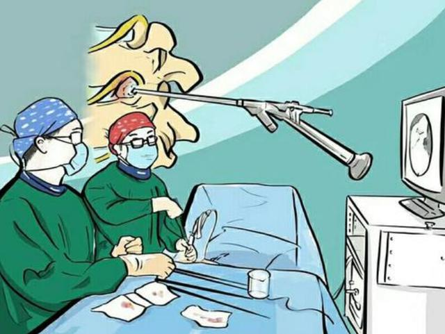 什么是软式内镜镜急诊科普 ｜微创手术—什么是腔镜手术？_https://www.jmylbn.com_新闻资讯_第10张