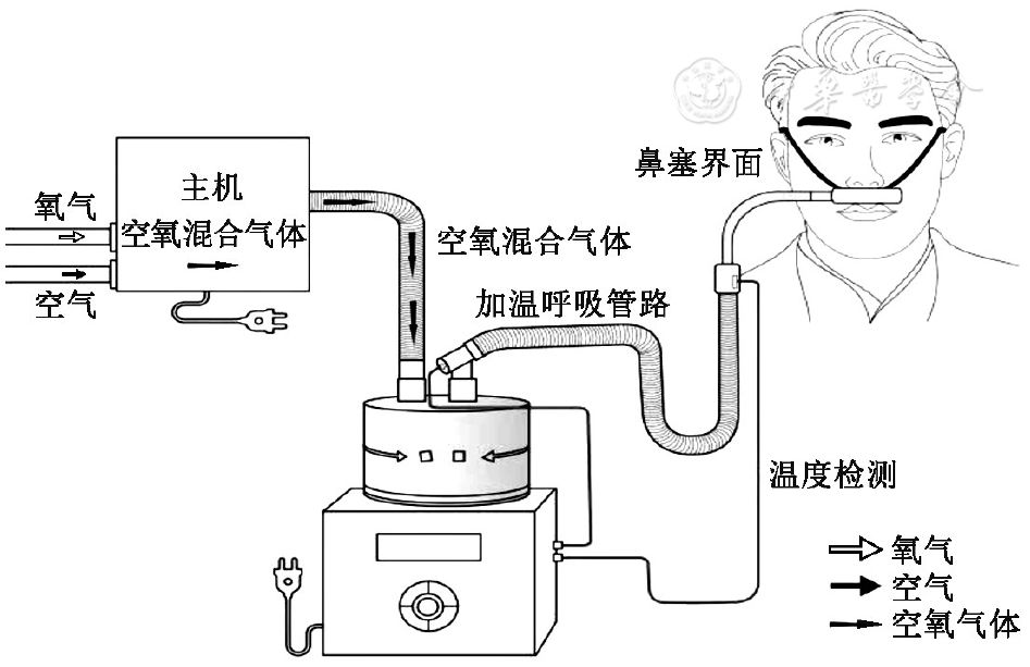 为什么用高流量呼吸【指南速览】成人经鼻高流量湿化氧疗临床规范应用专家共识_https://www.jmylbn.com_新闻资讯_第3张