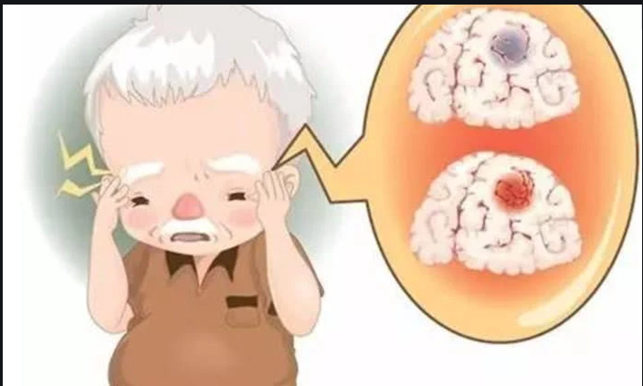 臭氧治疗什么病臭氧大自血针对各种疾病的治疗原理_https://www.jmylbn.com_新闻资讯_第3张