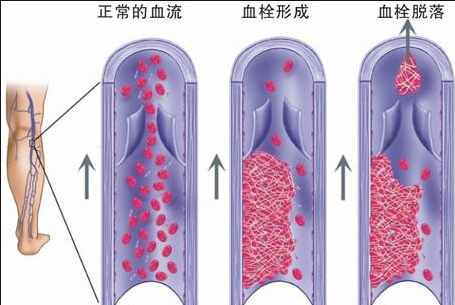 臭氧治疗什么病臭氧大自血针对各种疾病的治疗原理_https://www.jmylbn.com_新闻资讯_第5张