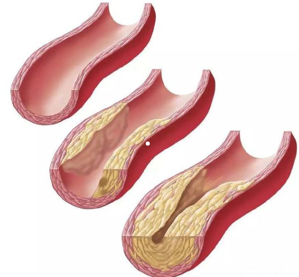 臭氧治疗什么病臭氧大自血针对各种疾病的治疗原理_https://www.jmylbn.com_新闻资讯_第4张