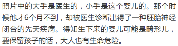 怎么用手抓到子宫21周的胎儿从子宫伸出“希望之手”抓住医生，生命的奇迹！_https://www.jmylbn.com_新闻资讯_第5张