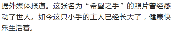 怎么用手抓到子宫21周的胎儿从子宫伸出“希望之手”抓住医生，生命的奇迹！_https://www.jmylbn.com_新闻资讯_第2张