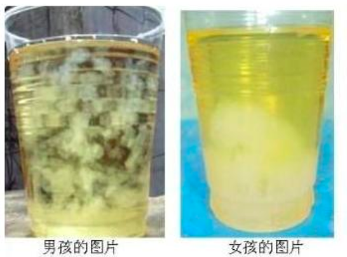 眼科ab超单怎么看男宝还是女宝，10个判断方法，B超单你注意了吗？_https://www.jmylbn.com_新闻资讯_第4张