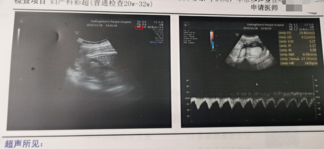 眼科ab超单怎么看男宝还是女宝，10个判断方法，B超单你注意了吗？_https://www.jmylbn.com_新闻资讯_第2张