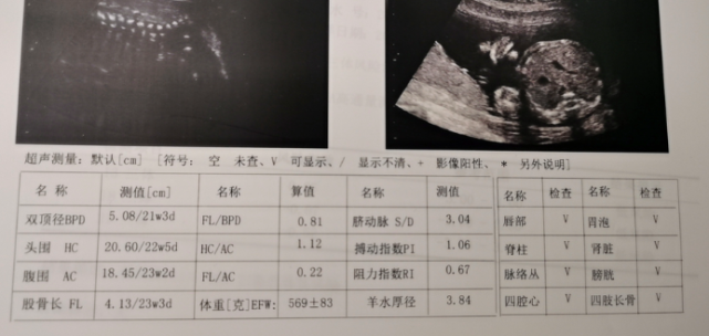 眼科ab超单怎么看男宝还是女宝，10个判断方法，B超单你注意了吗？_https://www.jmylbn.com_新闻资讯_第3张