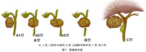 中国胆瘘消化内镜诊治专家共识2020北京