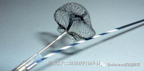 取石网篮 为什么贵EUS-BD操作中的细节：导丝如何超选？_https://www.jmylbn.com_新闻资讯_第18张