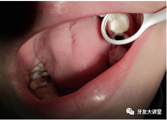 口腔颊面管怎么放置【口腔护士】与【医生】手术操作配合 7大流程，值得收藏！_https://www.jmylbn.com_新闻资讯_第9张