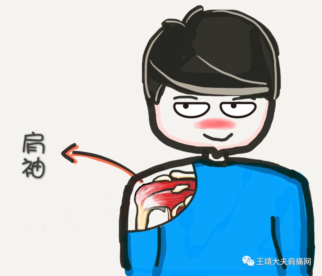 > 肩痛科普知识系列问答(16)什么叫肩袖?主要作用是什么?
