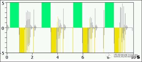 呼吸机vt是什么意思眼见为实！VT900A／650呼吸波形解析及阈值调整_https://www.jmylbn.com_新闻资讯_第11张