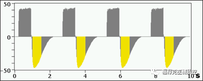 呼吸机vt是什么意思眼见为实！VT900A／650呼吸波形解析及阈值调整_https://www.jmylbn.com_新闻资讯_第5张