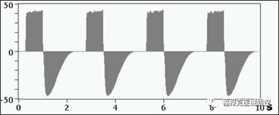 呼吸机vt是什么意思眼见为实！VT900A／650呼吸波形解析及阈值调整_https://www.jmylbn.com_新闻资讯_第6张