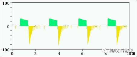 呼吸机vt是什么意思眼见为实！VT900A／650呼吸波形解析及阈值调整_https://www.jmylbn.com_新闻资讯_第9张