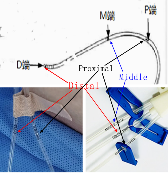 中心导管怎么使用如何区分双腔及多腔导管的各个腔？测量中心静脉压使用哪一腔？一文读懂_https://www.jmylbn.com_新闻资讯_第5张